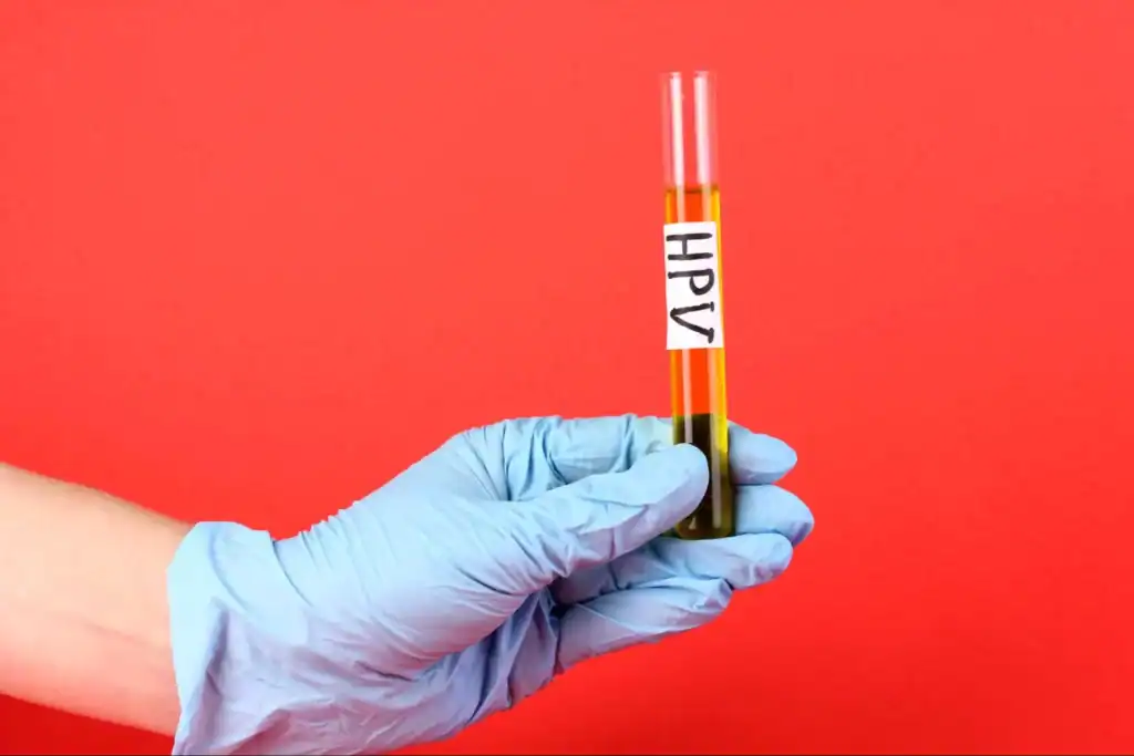 ตรวจ hpv ยังไง