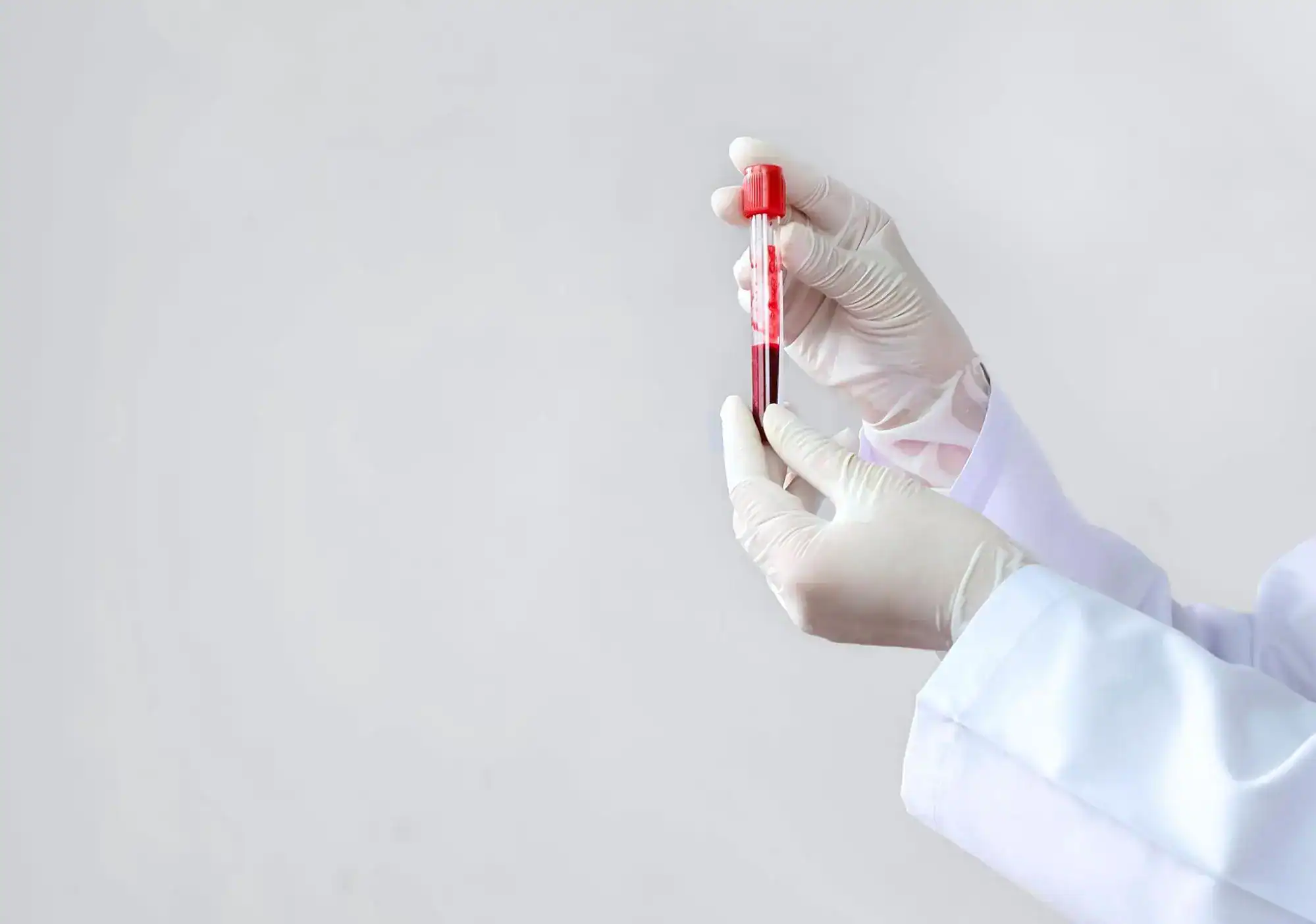 ตรวจเลือดหาการตั้งครรภ์