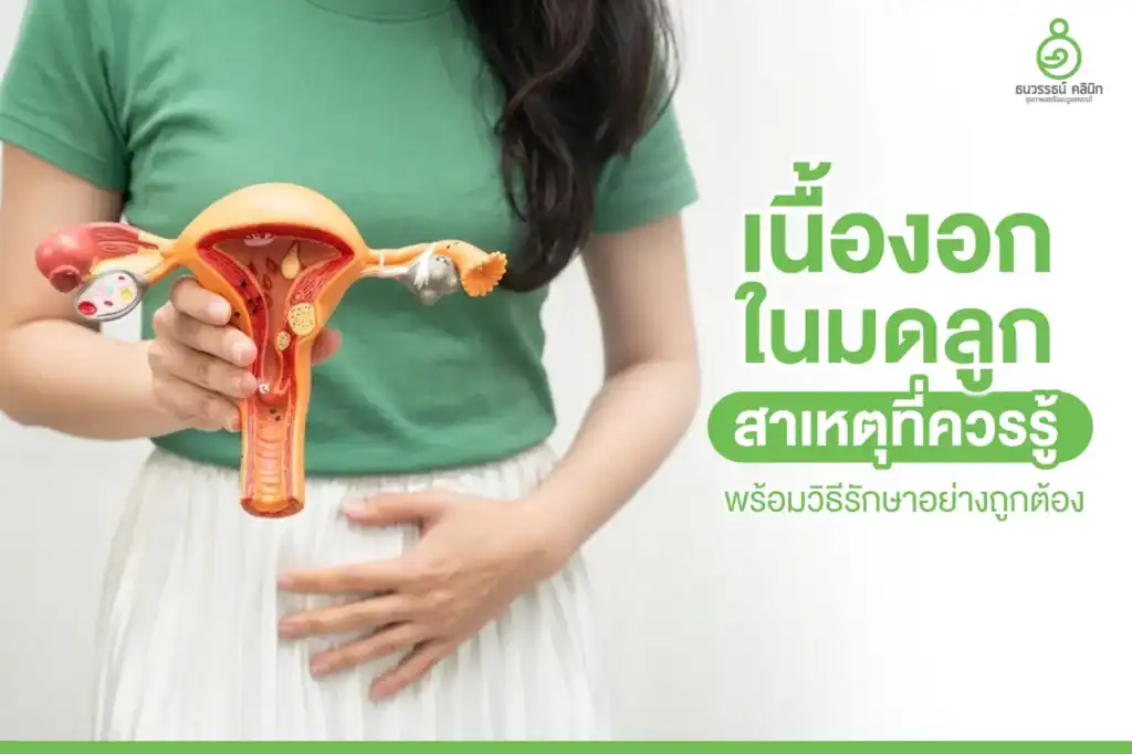เนื้องอกในมดลูก